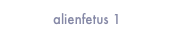 alienfetus 1